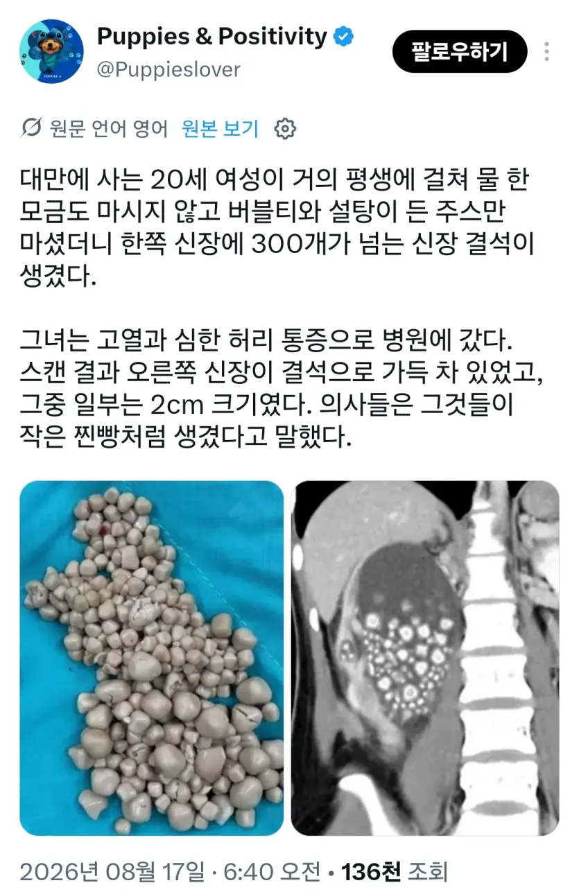 물-안마시고-살면-위험한-이유